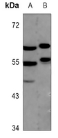 WB - Anti-MEF2A Antibody AP60480